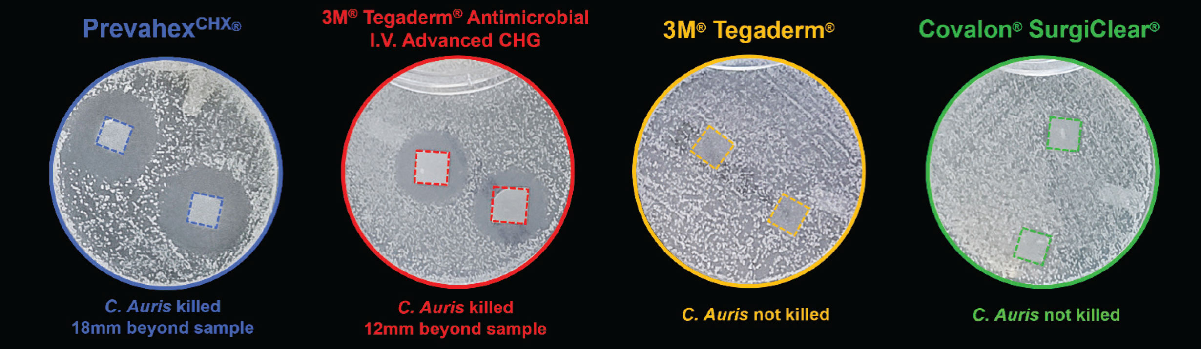 C auris results